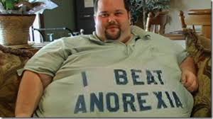 Obese public puts strain on NHS finances 